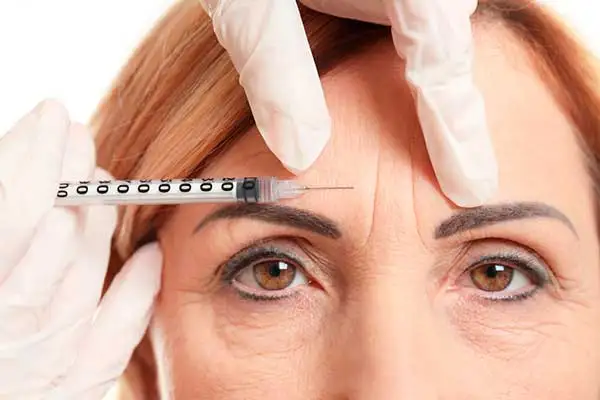 Botox facial dura quanto tempo? Saiba o que esperar do procedimento