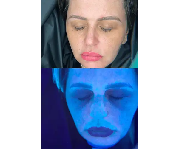 Derma Scan Derma Scan