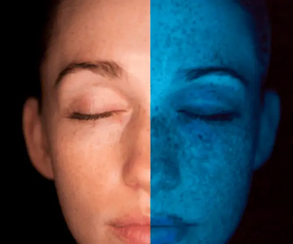 Derma Scan Derma Scan